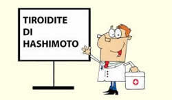 Tiroidite di Hashimoto